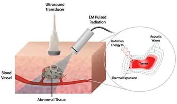 thermoacoustic-evaluation
